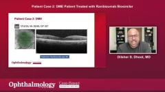 EP. 2 Patient case 2: DME Patient Treated with Ranibizumab Biosimilar