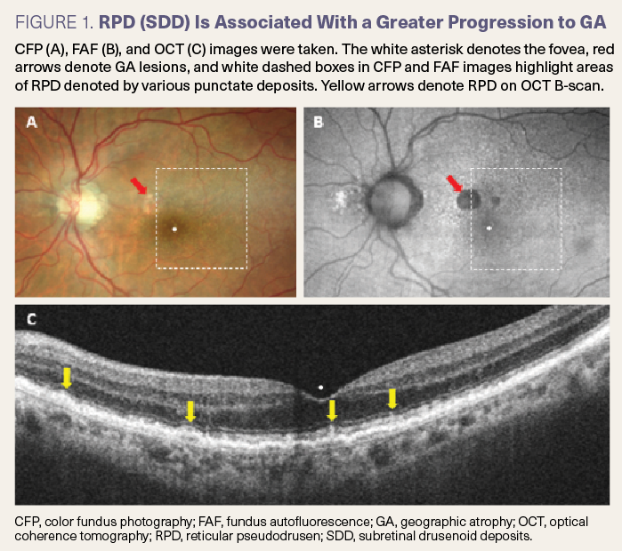 Ga Oct Unlocking geographic atrophy
