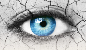 Rethinking dry eye disease with acute steroid treatment