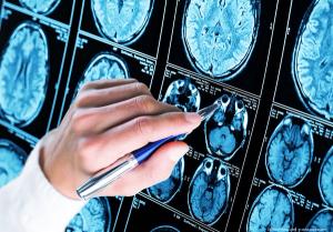 Potential new imaging method to rapidly differentiate similar neurodegenerative diseases