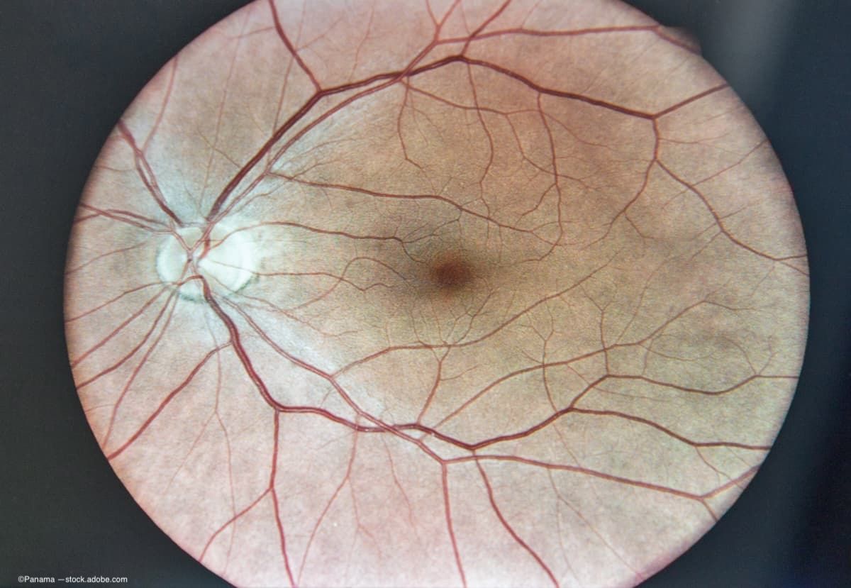 Advanced therapies for retinal vascular diseases