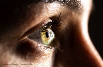 (Image credit: AdobeStock/Alessandro Grandini) Q&A: Insights from Rajesh K. Rajpal, MD, on an incision-free keratoconus therapy