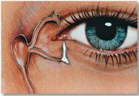 Form Fit Plug New intracanalicular punctum plug relieves dry eye
