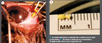 Antimicrobial device implanted in a patient's eye
