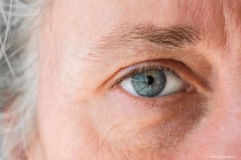 Novel MIGS stent technology boasts robust IOP-lowering effect in open-angle glaucoma