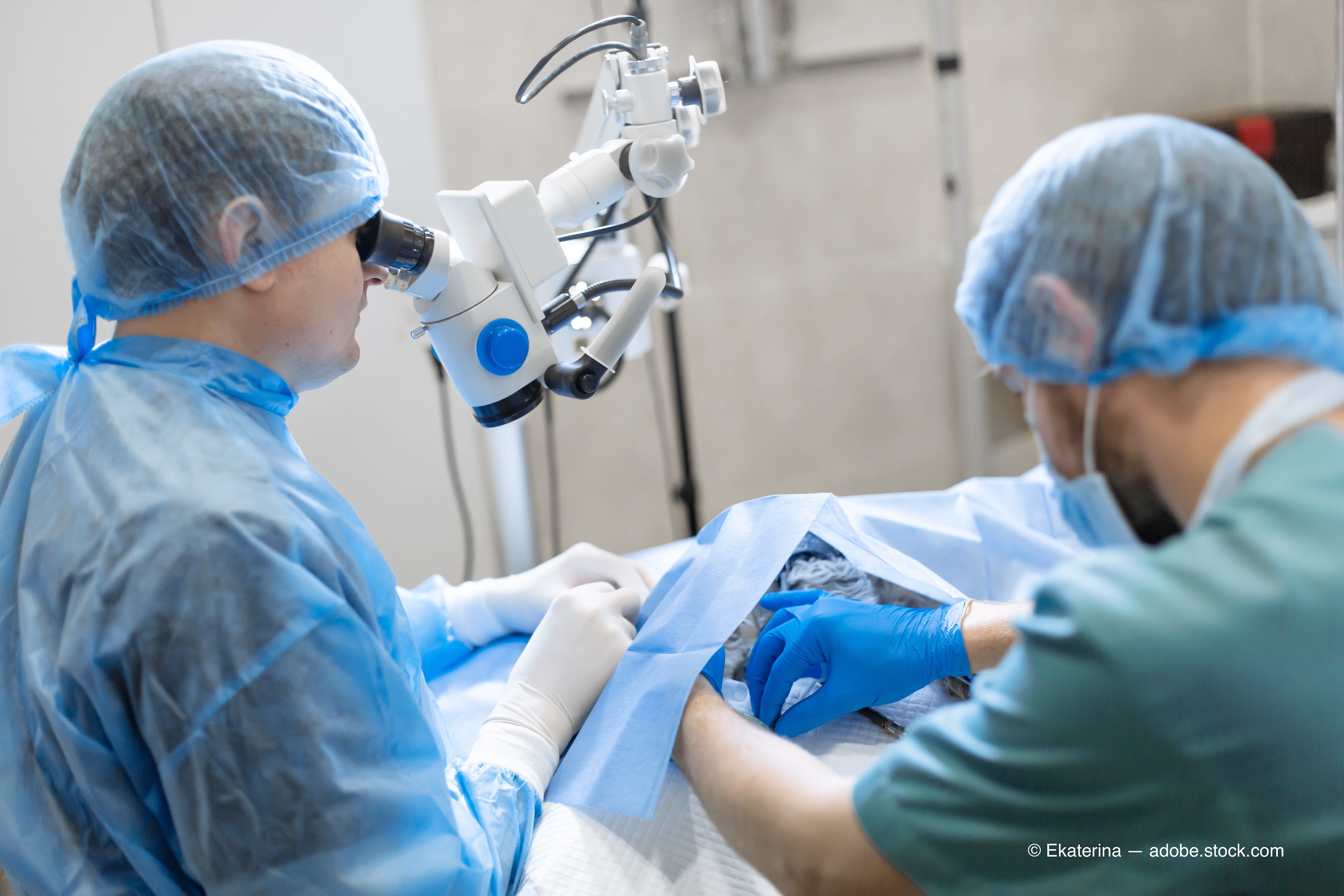 eyecare surgery procedure
