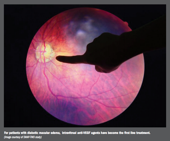  intravitreal anti-VEGF agents 
