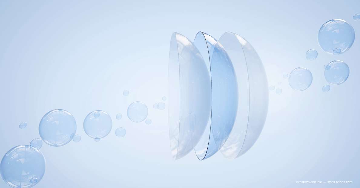 Prose Lens BostonSight publishes pilot study on PROSE scleral lenses as a drug ...