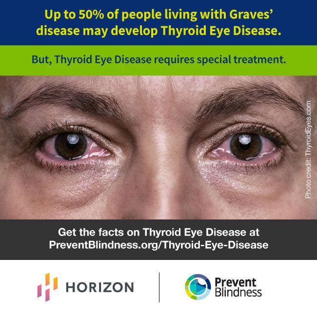 One of the infographics produced for Thyroid Eye Disease Awareness Week Nov. 14-20. 