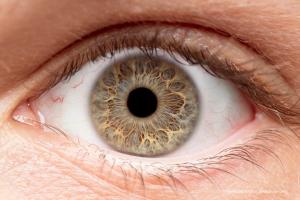 Extended depth-of-field lenses:  Understanding a new player in cataract surgery