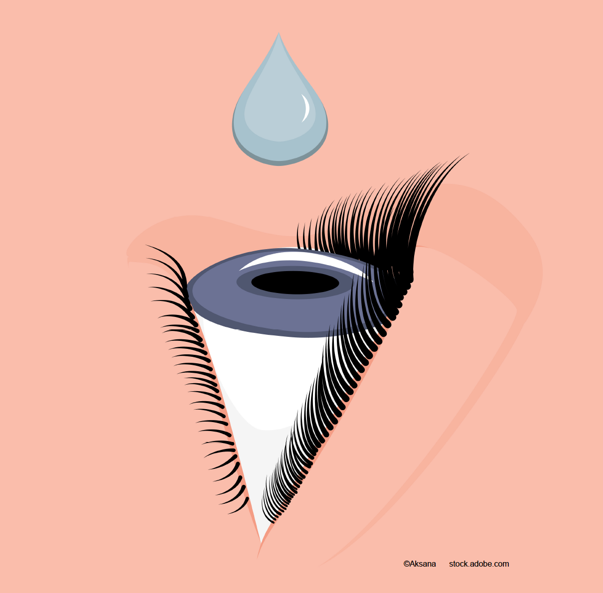 Combination, monotherapy or sub-Tenon prophylaxis: similar results?