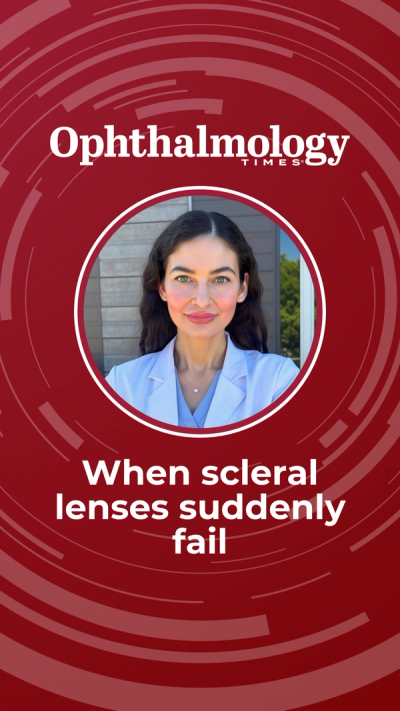 How co-management saved this patient's scleral lenses