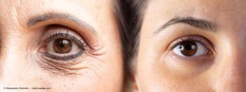 aging process