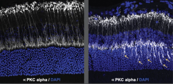 Representative images of retinal cryosections 