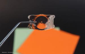 Pearls for incorporating phakic IOLs into your practice