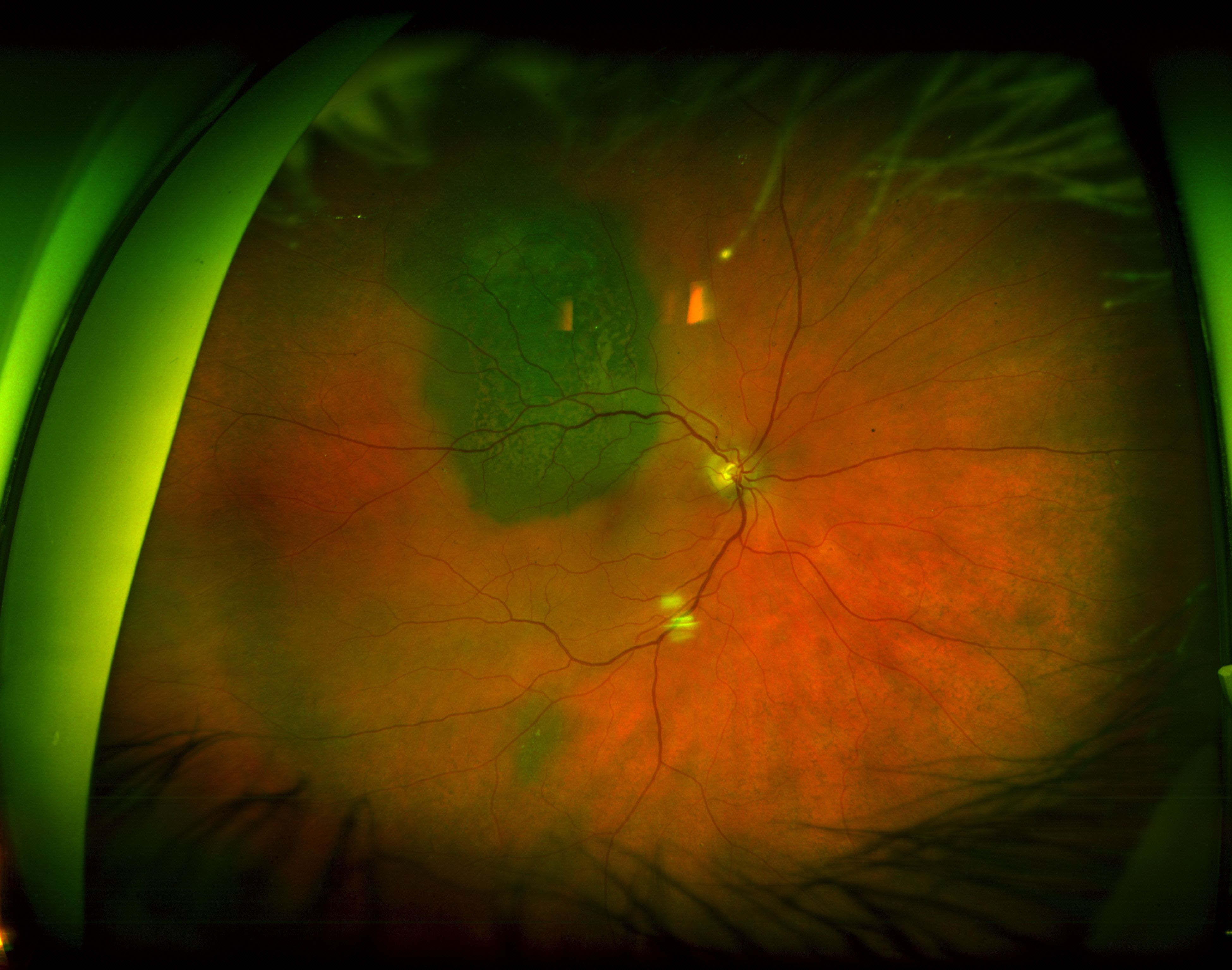 Ultra-widefield imaging can enhance efficiency for practices