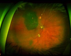 Ultra-widefield imaging can enhance efficiency for practices