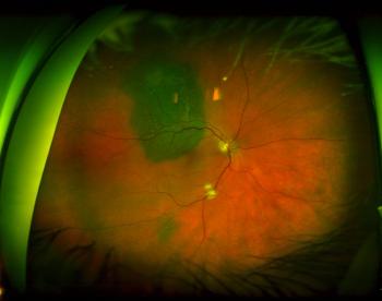 Ultra-widefield imaging can enhance efficiency for practices