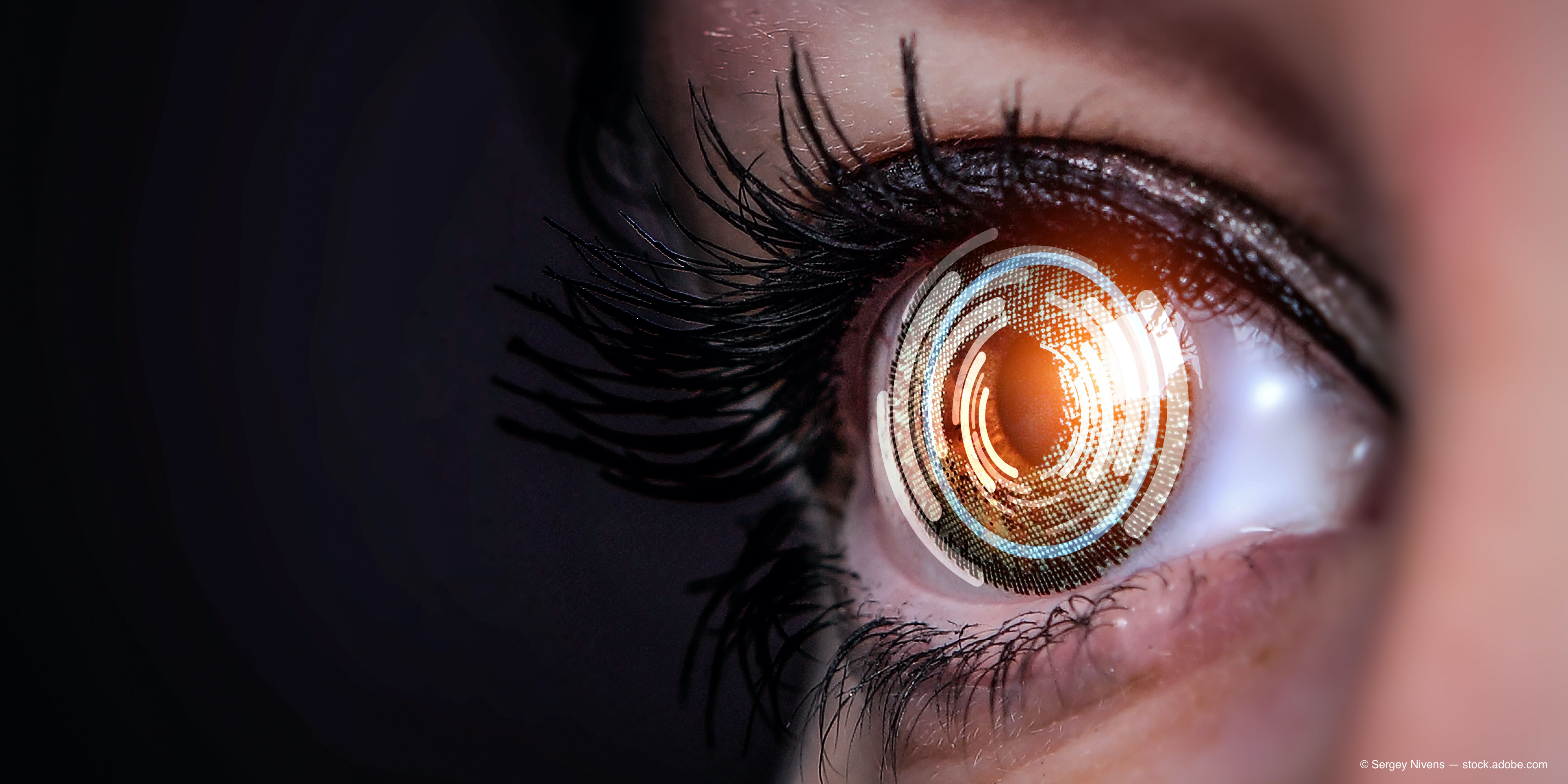 Teleretinal screening fails to do double duty for detecting glaucoma, cataracts