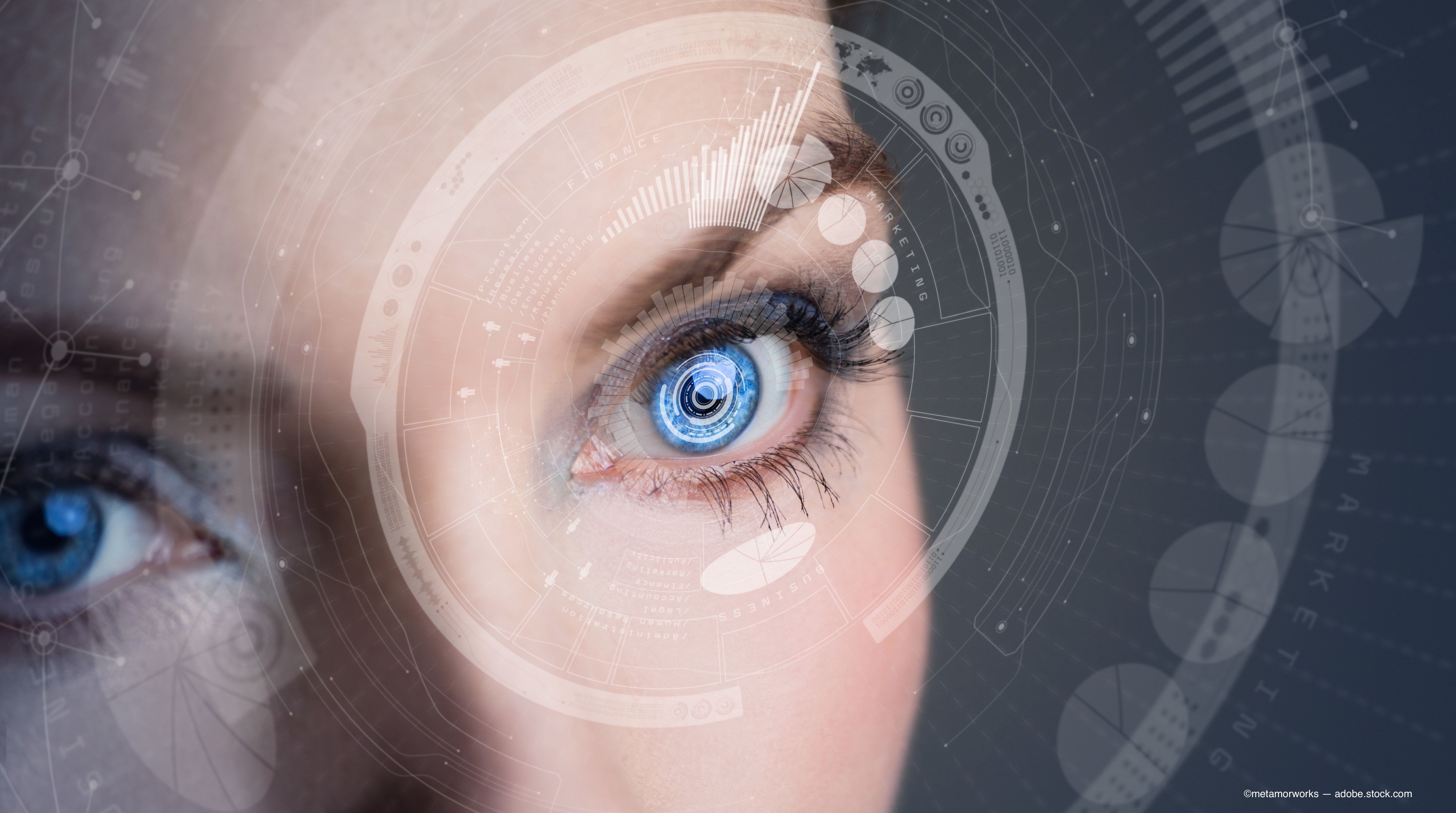 AI: Capturing more information from OCT in wet AMD