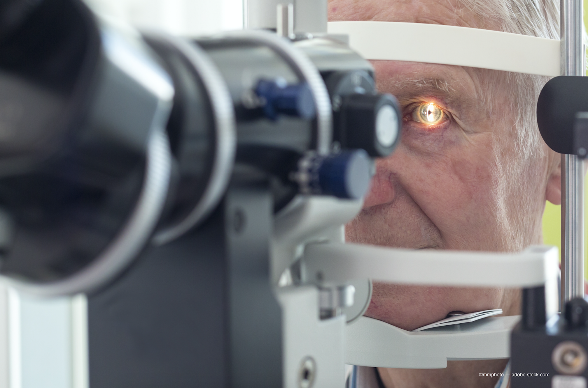 older man getting a cataract test done on his eye