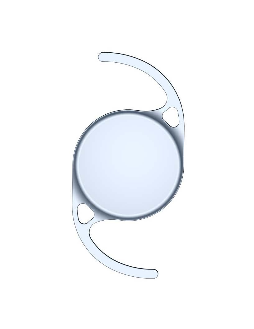 New IOL design gives premium results from non-premium lens