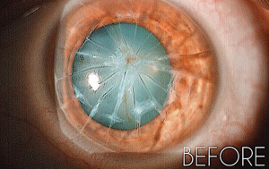 Show me the patients