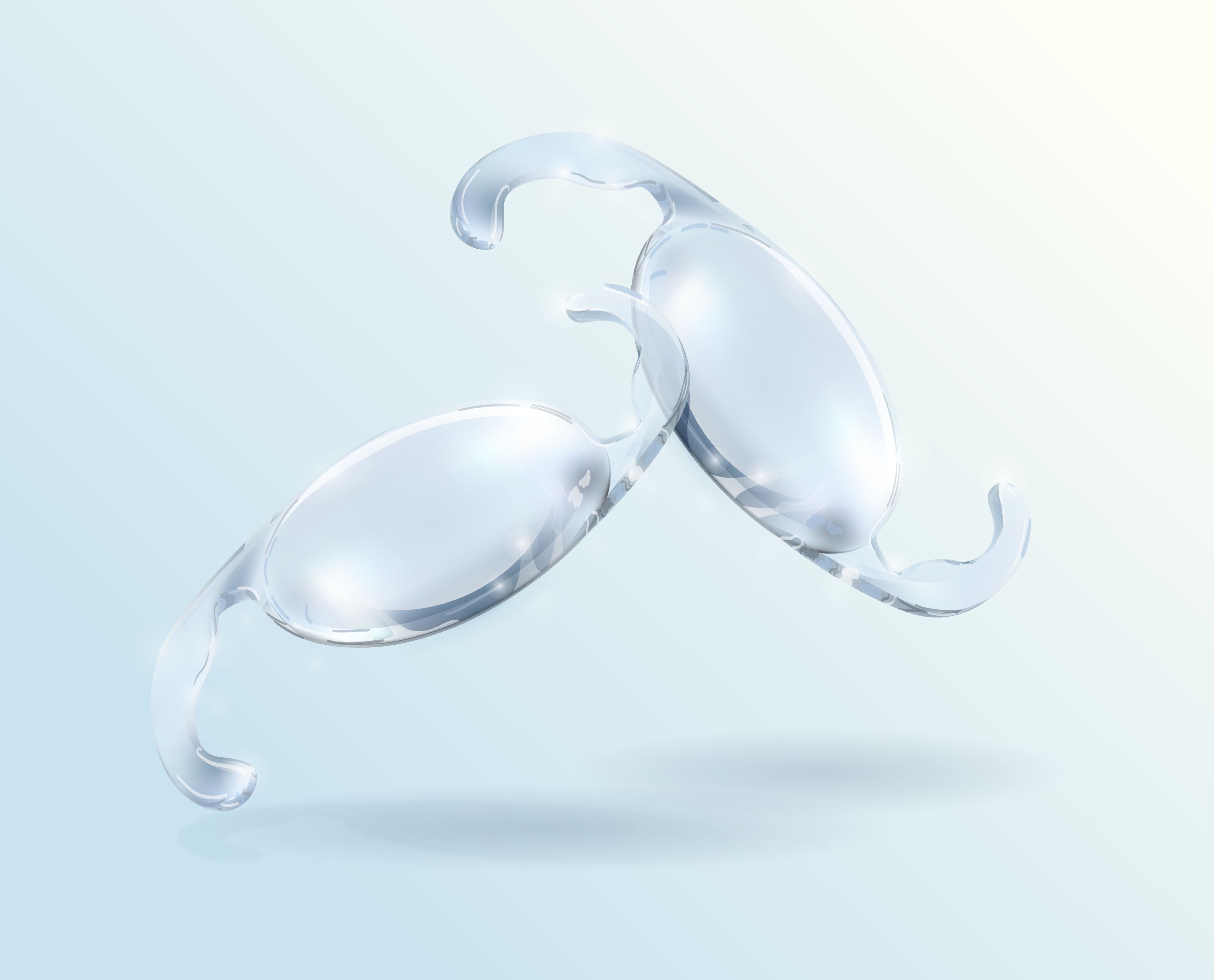 A comparison of 2 hydrophobic acrylic intraocular lenses (IOLs) evaluated the long-term formation of posterior capsular opacification (PCO) and the rate of glistenings that developed. (Image courtesy stock.adobe.com)