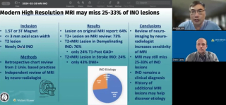 NeuroOp Guru: High-resolution MRI may miss a third of INO lesions