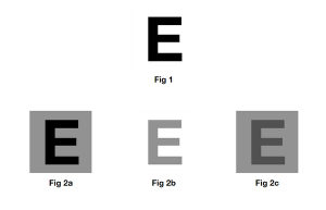 Troubleshooting post-presbyopia IOL complaints