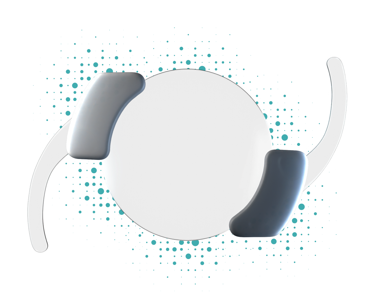 The SpyGlass BIM-IOL System. (Photo courtesy SpyGlass Pharma)