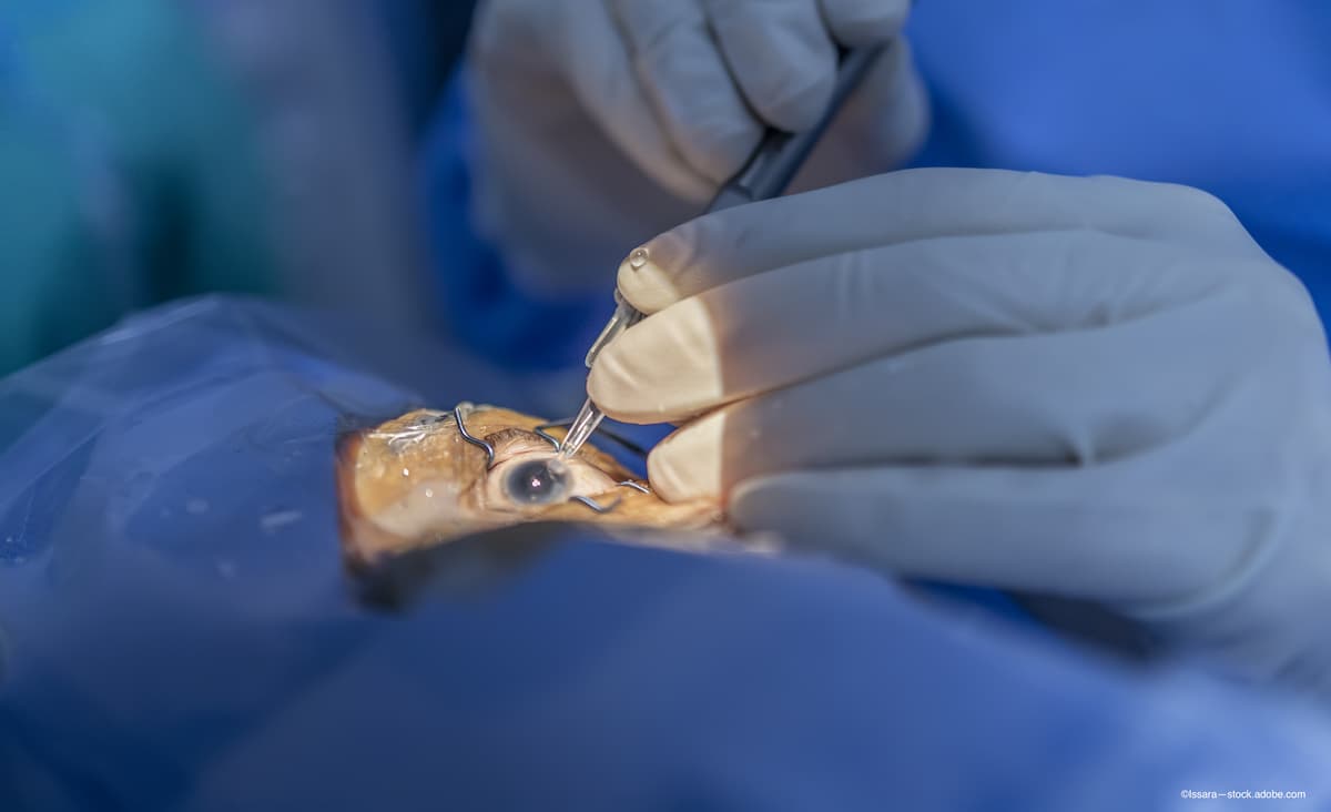 Toric IOLs for beginners: What to consider before and during surgery and in the postoperative period