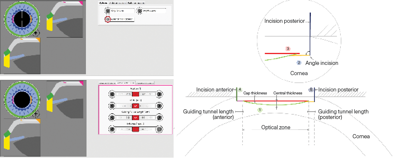 A chart reads, "Figure 2. SMILE outcomes. CT, comparative trial; RCT, randomised comparative trial; NOS, Newcastle-Ottawa Scale."