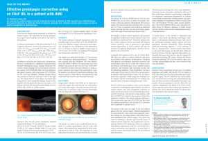 Effective presbyopia correction using an EDoF IOL in a patient with AMD