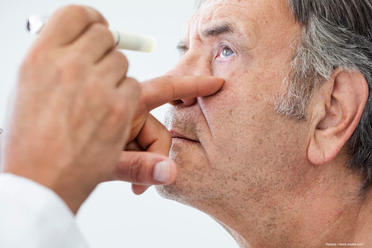 Link discovered between retinitis pigmentosa and increased risk of primary open-angle glaucoma