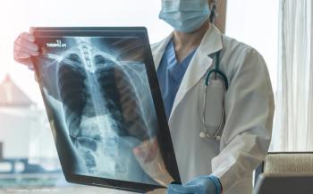 A doctor looks at a patient's chest x-ray. Image credit: ©Chinnapong – stock.adobe.com