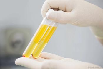 Plasma metabolomic profiles could predict AMD progression
