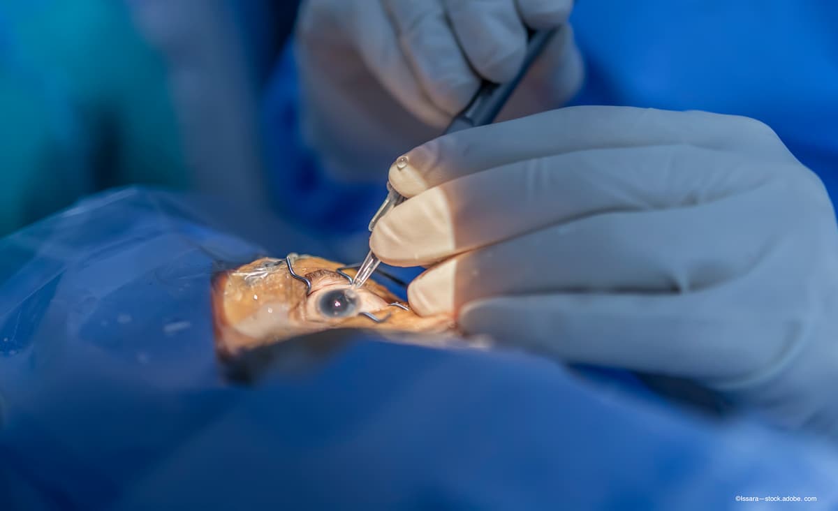 Good vision, minimal disturbances achieved with presbyopia IOL
