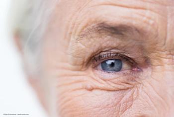 Faricimab approved by U.S. FDA for treatment of wet AMD, DMO