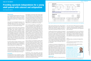 Providing spectacle independence for a young adult patient with cataract and astigmatism