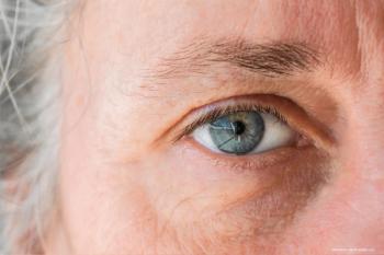 The need for precision management in glaucoma moves field forward