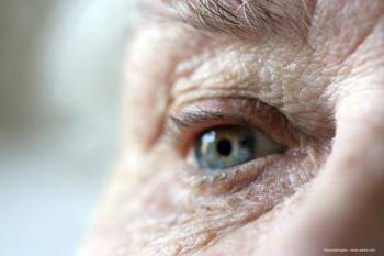 Using FLIO to monitor AMD progression