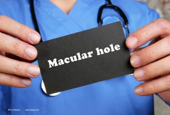 Treating persistent macular holes with heavy silicone oil