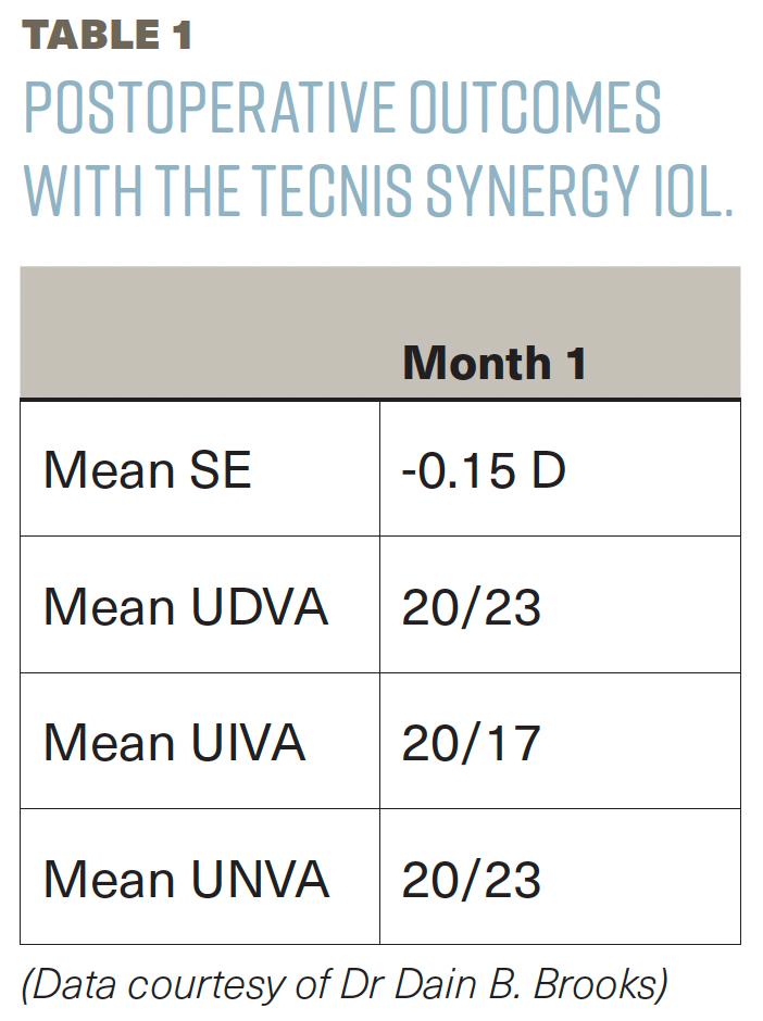 Table 1. Postoperative outcomes with the Tecnis Synergy IOL in my practice. (Data courtesy of Dr Dain B. Brooks)