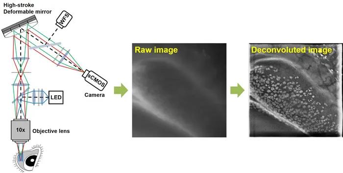 Image acquisition and image processing using the mouse conjunctiva as an example. (Image courtesy of POSTECH)