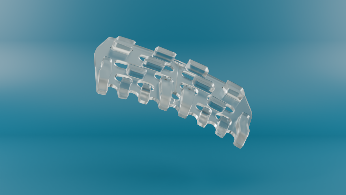 The Intercil Uveal Spacer from Ciliatech, which recently obtained a CE mark, does not penetrate the anterior of the eye. All images courtesy of Ciliatech.