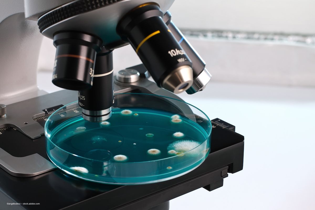 A petri dish with a fungal growth in solution sits beneath a microscope. Image credit: ©angellodeco – stock.adobe.com