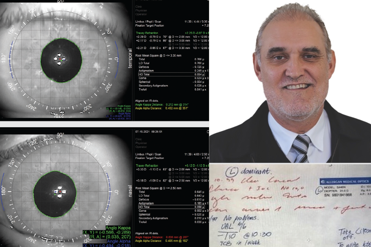 Custom matching IOLs is key to managing patient satisfaction – Ophthalmology Times Europe