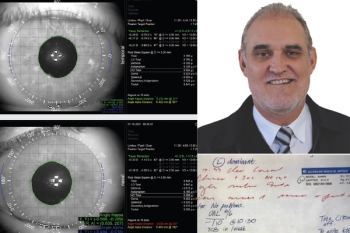 From left, clockwise: scans of a patient's left and right eyes; a photo of article author Johann Krüger, MD; Dr Krüger's handwritten notes from a custom match IOL implantation