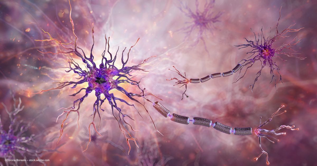 An image showing the degeneration of neuron cells. Image credit: ©Corona Borealis – stock.adobe.com